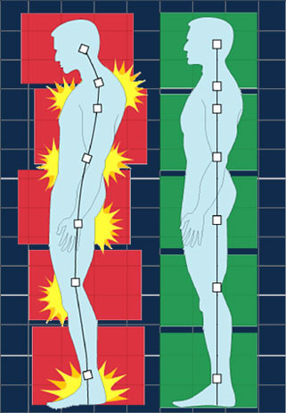 Image showing how thoracic spine exercises affect posture