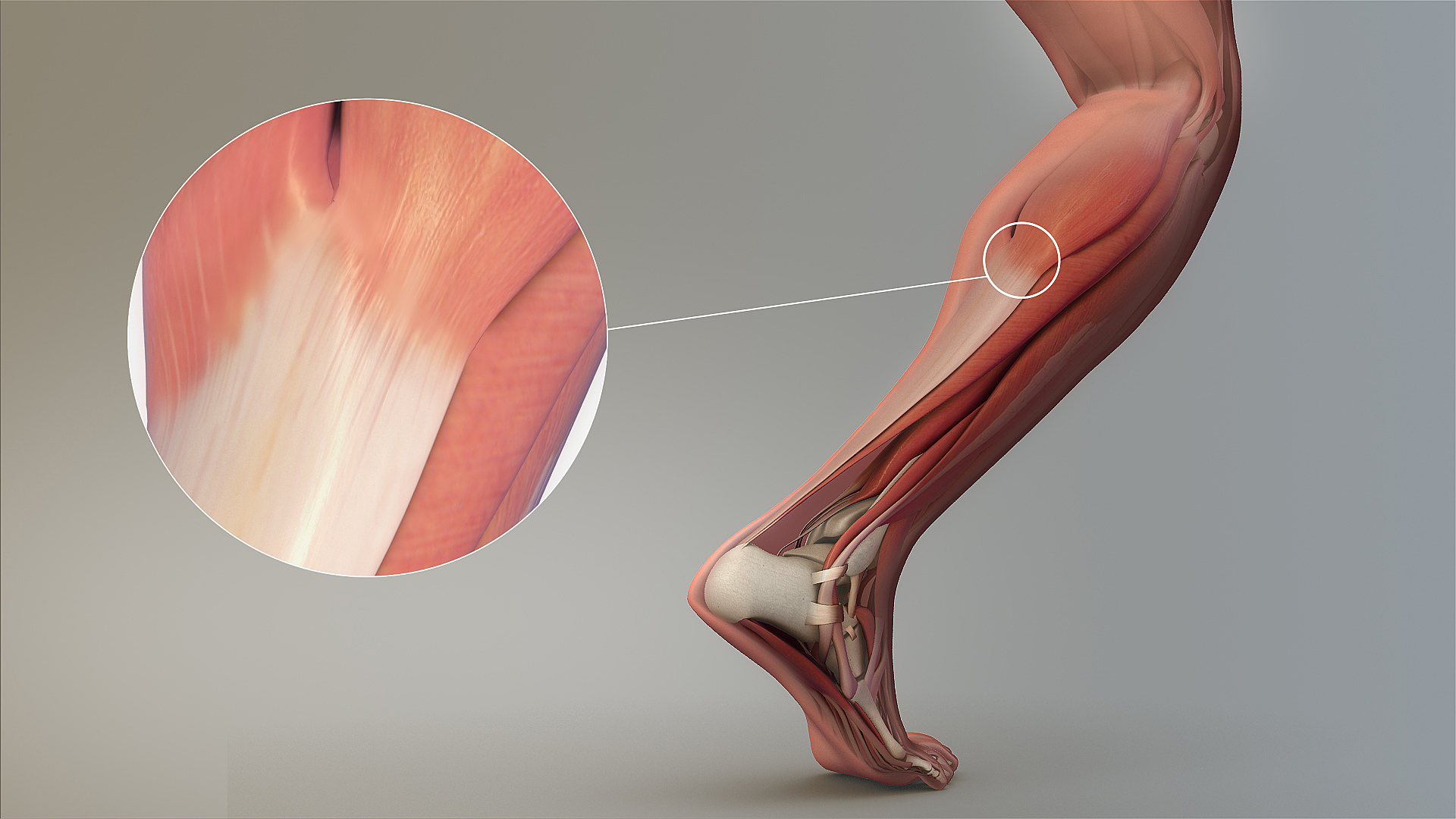 View of the achilles tendon during running